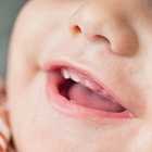 Почему малыши появляются на свет без зубов