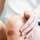 Почему на месте ушиба появляется синяк